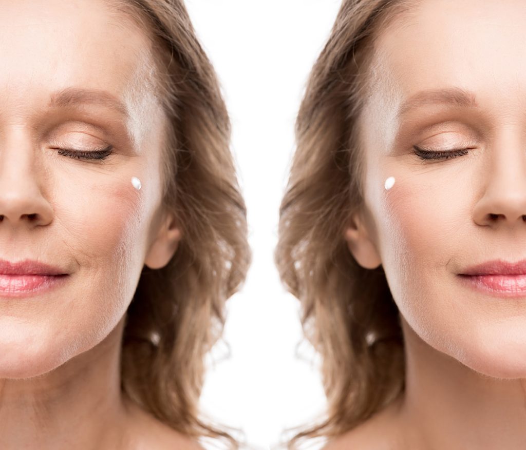 collage of mature woman with cosmetic cream on face before and after retouching Isolated On White