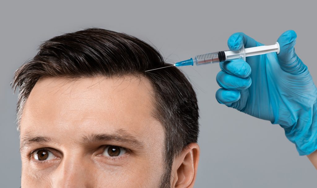 Mesotherapy for hair. Young man getting injections in head