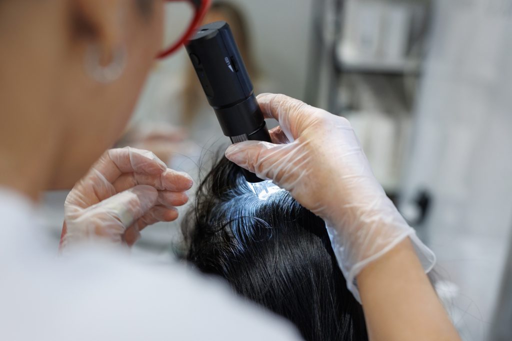 Treatment of the scalp from hair loss, alopecia. Fractional mesotherapy of the scalp.