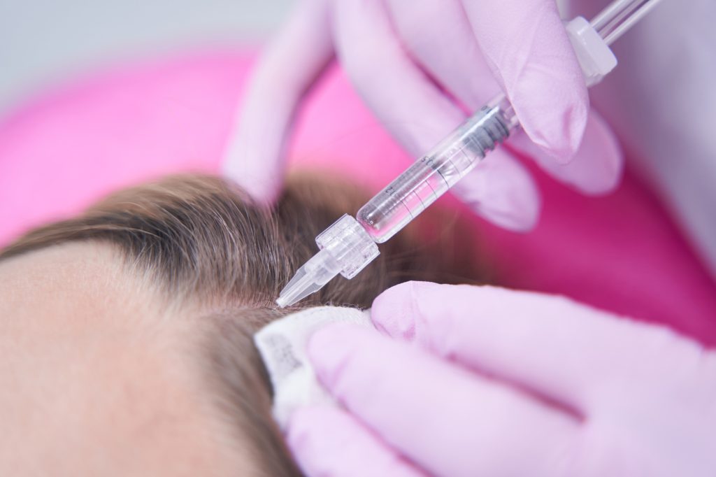 Trichologist treating patient for hair loss with injections