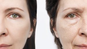 Armonización facial