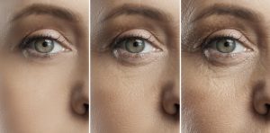 Bioestimulador facial