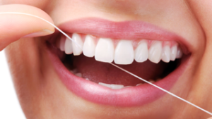 Blanqueamiento dental
