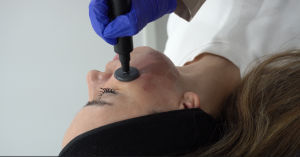 Postoperatorio Facial