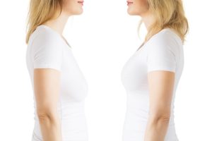 Mastopexia con implantes