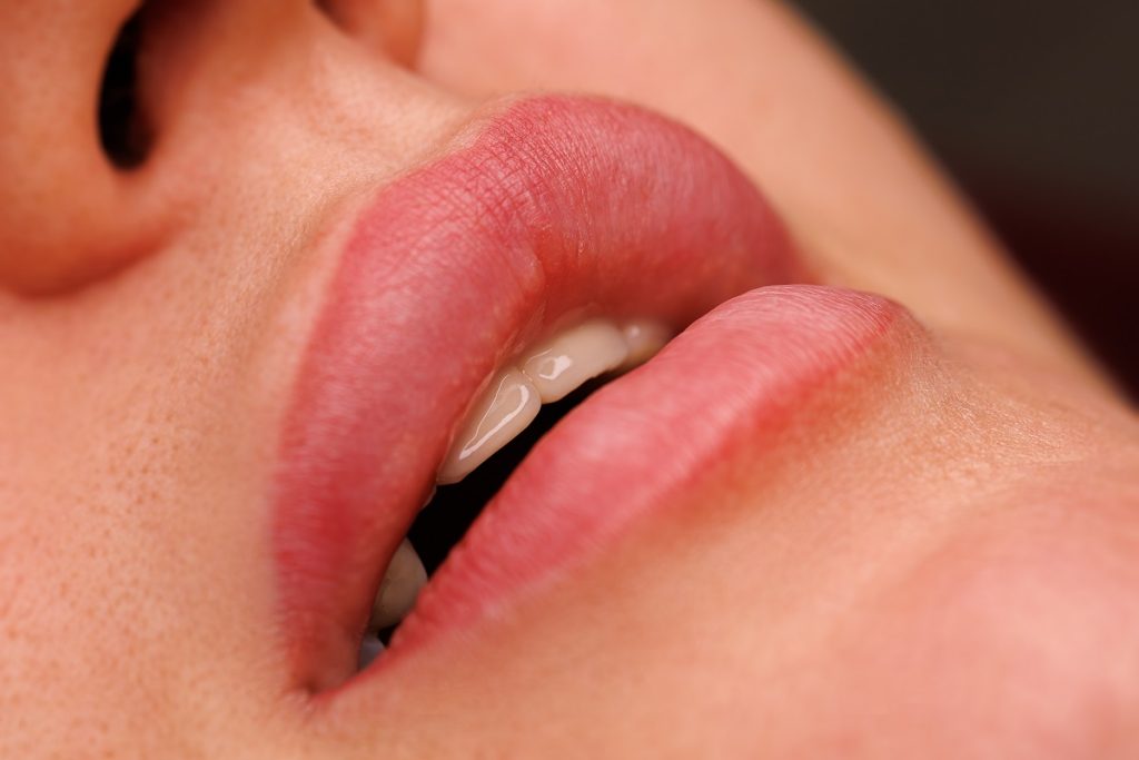 Primer plano de labios naturales antes de tratamiento estético