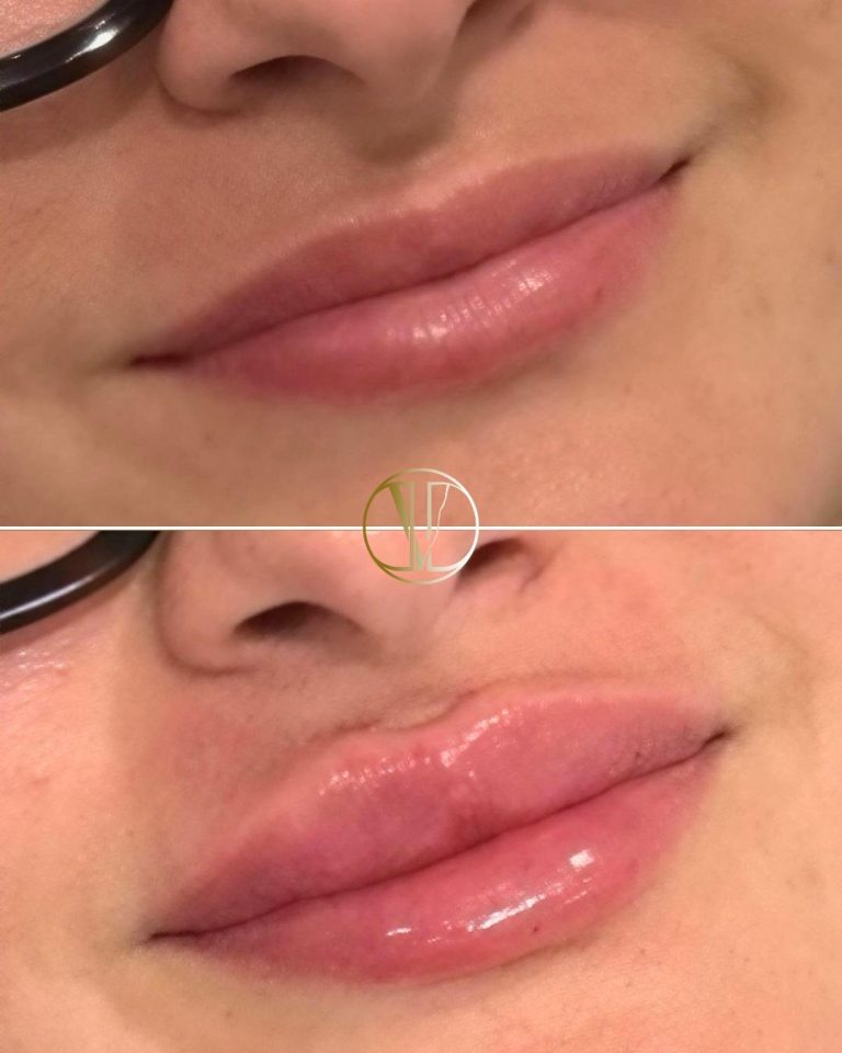 Labios rusos
