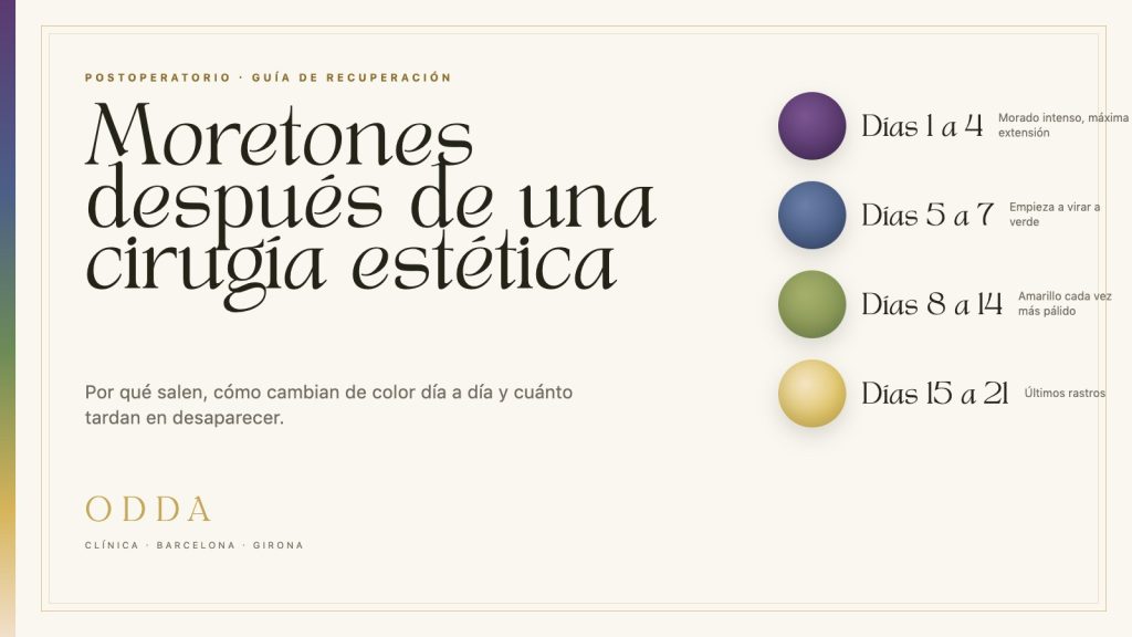 Moretones después de una cirugía estética: los colores del hematoma día a día