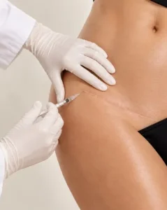 Tratamiento de cicatriz abdominal con protocolo combinado